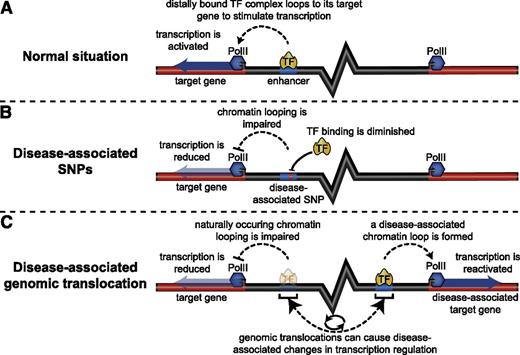 Figure 1. Genomic alterations can affect gene regulation via chromosome conformation. (A) Chromatin folding plays an essential role in transcriptional control by distally located regulatory elements. (B) Disease-associated single nucleotide polymorphisms located in distal regulatory elements can influence long-range chromatin interactions through their detrimental effect on the recruitment of TF complexes (eg, by destroying a TF binding motif), resulting in reduced expression of the target gene. (C) Chromosomal aberrations (eg, translocations) can relocate distal enhancers near a disease-associated gene, leading to the formation of pathological long-range chromatin interactions that ectopically activate the expression of this gene.