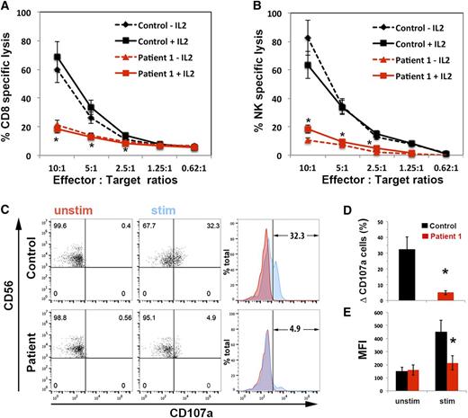 Figure 1. CTLs and NK cells expressing the STXBP2R65Q mutation exhibit impaired functions. (A) Cytotoxicity assay to measure CTL-mediated cell killing. PBMCs from control (black) and P1 cells (red) were cultured with CD3/CD28 beads for 5 days and then incubated for 48 hours with (solid line) or without (dashed line) 200 U/mL of IL-2. Equivalent numbers of CD8+ T-cells (Effector) were purified from control and P1 PBMCs and then incubated with anti-CD3 antibody in the presence or absence of P815 target cells (Target) at the indicated cell ratios. The killing assay was run for 4 hours at 37°C, and the amount of lactate dehydrogenase released into the supernatant was quantified using a CytoTox 96 assay. (B) NK cytotoxicity was assessed using control and P1 PBMCs incubated with K562 target cells, as described in panel A. Target-cell lysis was normalized to the number of NK cells in the PBMCs to obtain the percent NK-specific lysis. (C) CD107a assay to measure degranulation. PBMCs from control and P1 were incubated in the presence (stim; blue) or absence (unstim; red) of K562 cells for 4 hours at 37°C. Cells were stained using anti-CD107a-PE, anti-CD56-APC, anti-CD8-FITC, and anti-CD3-PerCP antibodies and analyzed by flow cytometry. CD3–CD8–CD56+ cells were gated and analyzed for the appearance of CD107a on the surface after incubation with target cells. Plots are representative of 3 independent experiments. (D) Graph showing the percentage of cells that increased CD107a staining on stimulation. The term “δ CD107a” reflects the difference between the percentage of NK cells expressing CD107a after K562 stimulation and the percentage of cells expressing surface CD107a after incubation with medium. (E) Mean fluorescence intensity (MFI) values in the CD107a-PE channel of unstimulated (unstim) vs stimulated (stim) cells. Results are the mean ± SD of 3 independent measurements for P1 and 10 different normal controls. *P < .01.