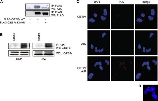 Figure 1. C/EBPε is acetylated in neutrophil progenitors. (A) COS cells were transfected with Flag-C/EBPε or Flag-C/EBPε K15xR, followed by Flag immunoprecipitation. Cell lysates were analyzed by WB, using anti-acetylated lysines (AcK) and anti-Flag antibodies. (B) NB4 cells were treated with retinoic acid over the course of 4 days. HL60 cells and NB4 cells were treated with KDACi over the course of 3 hours, followed by AcK immunoprecipitation. Cell lysates were analyzed by WB, using anti-C/EBPε and AcK antibodies. (C) PLA was performed in CD34+-derived neutrophil progenitors, probed for C/EBPε and AcK. The PLA signal (red dots) represents acetylation of C/EBPε. (D) Magnified view of PLA signal. Data are representative of at least 3 independent experiments. IP, immunoprecipitation; WB, western blot; WCL, whole-cell lysate. #, a specific band.