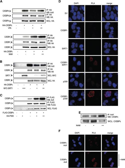 Figure 2. C/EBPε acetylation is regulated by SIRT1 and p300. (A) COS cells were transfected with HA-C/EBPε and treated overnight in the absence or presence of 500 μM (+), 1 mM (++) VPA, 1 mM (+), 5 mM (++) NAM, followed by HA immunoprecipitation. Cell lysates were analyzed by WB, using anti-acetyl lysines (AcK) and anti-HA antibodies. (B) COS cells were cotransfected with HA-C/EBPε and Myc-SIRT1, followed by HA immunoprecipitation. Cell lysates were analyzed by WB, using anti-AcK, anti-HA, and anti-Myc antibodies. (C) COS cells were cotransfected with Flag-C/EBPε and HA-p300, followed by Flag immunoprecipitation. Cell lysates were analyzed by WB, using anti-AcK, anti-Flag, and anti-HA antibodies. (D) COS cells transfected with FLAG-C/EBPε and HA-p300 or Myc-SIRT1, followed by PLA. Cells were probed for Flag, HA, or Myc. Single transfections and pMT2 empty vector were used as controls. PLA signal (red dots) represents colocalization of C/EBPε with p300 and SIRT1. (E) CD34+ cells were differentiated toward neutrophils. At day 10, cells were treated overnight with 5 mM NAM, followed by AcK immunoprecipitation. Cell lysates were analyzed by WB, using an anti-C/EBPε antibody. (F) Day 10 neutrophil precursors were isolated and treated overnight with NAM, followed by PLA. Cells were probed with anti-AcK and anti-C/EBPε antibodies. PLA signal (red dots) represents C/EBPε acetylation. IP, immunoprecipitation; NAM, nicotinamide; VPA, valproic acid; WB, western blot; WCL, whole-cell lysate. Data are representative of 3 or more independent experiments.