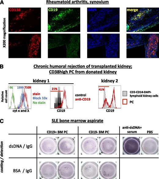 Figure 6. CD19− PC are detectable at sites of chronic inflammation and can secrete autoantibodies. (A) Synovial biopsies from 2 patients with rheumatoid arthritis were analyzed by immunofluorescence histology for the presence of CD138+DAPI+CD19+ and CD138+DAPI+CD19− PC (1 out of 2 cases is shown). Upper and lower panels originate from the identical staining and section. (B) Kidney tissue from 2 patients after humoral rejection was digested by collagenase V, and mononuclear cells were analyzed by flow cytometry for the presence of CD19+ and CD19− PC. PC were identified using high expression of CD38 within a wide lymphocyte gate and electronic depletion of CD3+ cells, CD14+ cells, and dead cells. In 1 of the 2 cases, CD19 expression by PC was controlled using an isotype-matched control antibody, and the PC identity was confirmed by the detection of intracellular immunoglobulin (cyt κ and λ Ab light chains). Numbers denote mean fluorescence intensities. (C) CD19+ and CD19− BMPC from 1 SLE patient (serum anti-dsDNA antibodies, 84 U/mL) were isolated and subjected to an Elispot assay detecting dsDNA-specific IgG-secreting cells among 24 000 CD19+ BMPC/well and 27 000 CD19− BMPC/well. Representative wells (from 14 dsDNA-coated replicate wells and 7 bovine serum albumin-coated replicate wells per PC subset to determine assay background) and assay controls are shown. After background subtraction, frequencies of dsDNA-specific PC were 0.8 and 1.3 PC per 10 000 total CD19+ and CD19− BMPC, respectively.