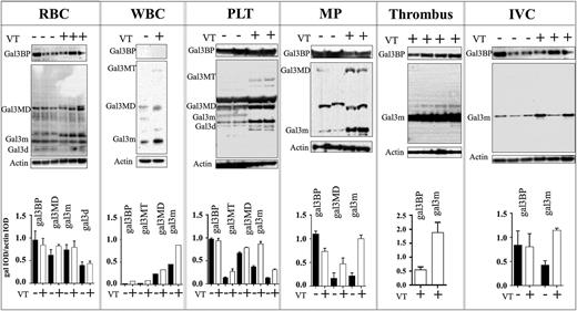 Figure 1. The effects of VT on Gal3BP and gal3 in blood-circulating elements (systemic) or thrombus and vein wall (Local). Western blot and quantification: western blot analysis of gal3BP and gal3 in RBCs (n = 1 per band), WBCs (n = 5 per band), PLTs (n = 3 per band), procoagulant microparticles (n = 3 per band), thrombus (n = 1 per band), and vein wall (n = 1 per band) collected from non-VT (–) (n = 21) or VT (+) (n = 25) mice 48 hours postthrombosis. Actin was used as a loading control. Quantification of blot intensity relative to loading control is shown below. gal3BP, galectin 3–binding protein; gal3, galectin 3; gal3m, gal3 monomer; gal3MD, gal3 multimer dimer; gal3MT, gal3 multimer trimer; gal3d, gal3 degradation product; IVC, vein wall; MP, procoagulant microparticles.