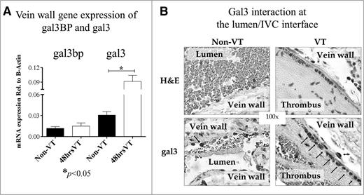 Figure 2. The effects of VT on Gal3BP and gal3 in vein wall and thrombus (local). Gene expression and Histology. (A) Analysis of gal3BP and gal3 in vein wall by qRT-PCR: gal3BP and gal3 mRNA isolated from the IVC (vein wall) of non-VT (n = 8) or 48 hours VT (n = 12) WT mice were quantified using qRT-PCR. Gene expression was quantified relative to β-actin. (B) H&E and IHC for gal3. H&E stain and IHC for gal3 in both non-VT and VT conditions. Arrows indicate positive stained cells. Of note, the number of gal3 positive cells were increased on VT condition.