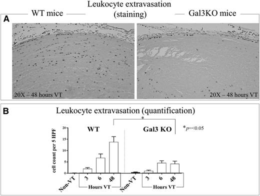 Figure 6. Leukocyte infiltration into the vein wall of WT and Gal3KO mice. (A) Representative pictures of 48 hours postthrombosis initiation showing leukocyte infiltration in C57Bl/6 mice and Gal3KO mice (original magnification ×20). (B) Quantification of leukocyte migration into the vein walls of WT and Gal3KO mice at 3 hours, 6 hours, and 48 hours (n = 5 per time point) post-IVC ligation, and non-VT (n = 5) were examined under high-power oil-immersion light microscopy. Note that in Gal3KO mice, leukocyte extravasation was significantly depressed compared with WT mice at 48 hours after thrombosis was initiated, the time point used for most of the experiments described in this manuscript.