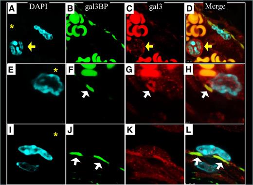 Figure 8. Gal3BP and gal3-mediated leukocyte interactions with the IVC. Sockets distribution of gal3bp appears to be interacting with gal3 rich leukocytes (H,L). Red blood cell fluorescence is predominately nonspecific autofluoresence. The IVC lumen is indicated with an asterisk in DAPI images. Yellow arrows indicate WBC that is not attached to the vein wall. White arrows indicate gal3bp sockets on the vein wall. (A,E,I) Nuclear DAPI staining. (B,F,J) Gal3bp localization (FITC). (C,G,K) Gal3 localization (Texas Red). (D,H,L) Merge of images.