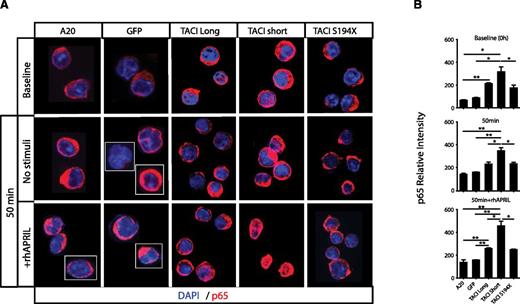 Figure 3. TACI isoform intracellular signaling leads to NF-κB activation. (A) Confocal microscopy of A20 nontransduced cells, A20 with GFP, TACI short or long isoforms, and nonsignaling TACI S194X mutant cells. After 6 hours of starving (baseline), 1 × 106 cells were cultured for 50 minutes in complete RPMI 1640 medium in the presence or absence of 100 ng/mL of rhAPRIL, and stained for p65 (red); nuclei were counterstained with DAPI (blue). Images show white dividing lines for cells taken from the same field. Original magnification ×63. (B) Quantitative assessment of p65 expression (relative to cell number), represented as p65 relative intensity, for each condition. For quantitation of total p65, >200 cells were microscopically assessed and analyzed with ImageJ software. The mean percentage and standard error were calculated from 3 independent experiments; Error bars represent standard error of the mean. *P < .05; **P < .01; 2-tailed unpaired Student t test.