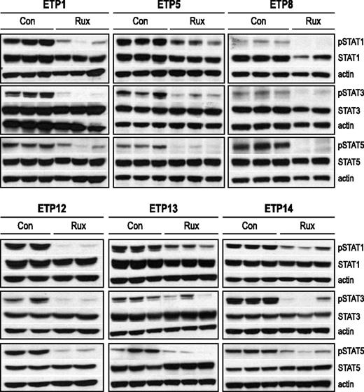 Figure 6. Down-regulation of JAK targets with ruxolitinib treatment. Levels of phosphophorylated (p) and total STAT proteins in the spleens of ETP-ALL xenografts. Xenografts (2-3 mice per arm, replicates shown) were treated with ruxolitinib (rux) or vehicle (con) for 72 hours, spleens were harvested, and protein lysates were subjected to immunoblot. Protein levels by immunoblot of replicates were quantitated relative to actin and analyzed by the Welch-Satterthwaite t test. Levels of pSTAT1 were reduced by >50% in treated mice compared with control for all 6 samples (P < .05). There was a >50% reduction in pSTAT3, which was statistically significant (P < .05) for ETP1, 5, 8, and 14 but not significant for ETP12 and 13. There was a 70% or greater reduction in pSTAT5 for all 6 samples (P < .05).