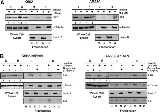 Figure 6. Enhanced RAN/XPO1 shuttling activity is associated with enhanced levels of cytoplasmic SET in TKI-resistant CML cell lines. (A) Whole cell, nuclear, and cytoplasmic lysates of K562S, K562R, AR230S, and AR230R cells (n = 3) either untreated or treated with 1 μM imatinib were separated by SDS-PAGE and analyzed for SET expression and subcellular localization by immunoblot analyses. The α-tubulin and lamin B fractionation blots overlap with that of Figure 4A. (B) Whole cell, nuclear, and cytoplasmic lysates of K562S, K562R, AR230S, and AR230R cells (n = 3) expressing shRAN in the presence or absence of doxycycline were separated by SDS-PAGE and analyzed for SET expression and subcellular localization.