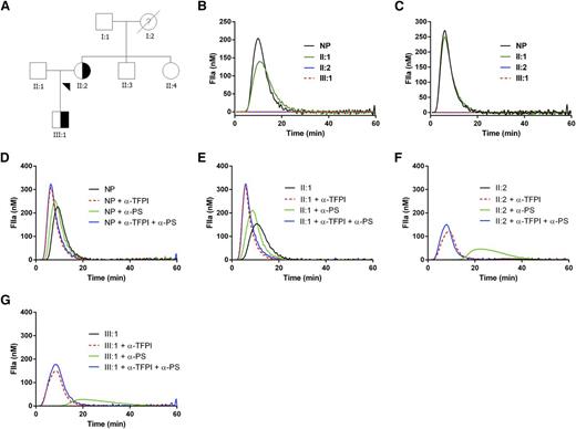 Figure 1. Pedigree of the family with the inherited bleeding disorder and thrombin generation in the affected relatives. (A) Pedigree of the family with the inherited bleeding disorder. Affected individuals are indicated by shapes filled half-way; unaffected individuals are indicated by nonfilled shapes; and nonfilled shapes with ? indicate disease status unknown. Blood samples were collected from all living relatives to assess coagulation parameters and ultimately to perform whole exome sequencing. (B-G) Thrombin generation in the affected relatives. Thrombin generation was initiated with (B) 1 or (C) 5 pM tissue factor in normal pooled plasma (NP), the proband (II:2), her son (III:1), and husband (II:1). Thrombin generation could be restored in the affected relatives by addition of blocking antibodies against TFPI or protein S. Thrombin generation was initiated with 1 pM tissue factor in (D) normal pooled plasma (NP), (F) the proband (II:2), (G) her son (III:1), and (E) husband (II:1) in the absence or presence of blocking antibodies against TFPI or protein S. Similar results were obtained with 5 pM tissue factor (data not shown).