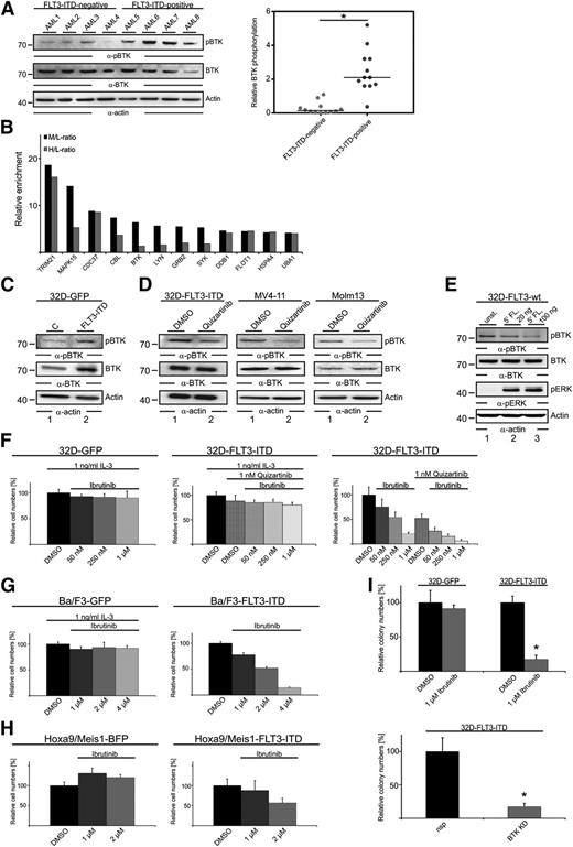 Figure 2. BTK acts downstream of FLT3-ITD to induce proliferation in AML cells. (A) Cleared cellular lysates of patient-derived AML cells (12 FLT3-ITD–positive and 12 FLT3-ITD–negative patients) were subjected to immunoblotting with antibodies against pBTK (upper panels) and BTK (middle panels). Protein loading was monitored by anti-actin immunoblotting (lower panels). The right panel shows the BTK phosphorylation normalized to BTK expression based on the signal intensities measured by immunoblotting. (B) The endogenous FLT3-ITD interactome was identified in MV4-11 cells using quantitative SILAC-based MS. All proteins identified that showed a medium (M) vs light (L) ratio (M/L) greater than 4 are plotted according to their M/L ratio and heavy (H) vs light (H/L) ratios of enrichment on logarithmic scales. Proteins with an M/L ratio greater than 4 were identified as interaction partners of FLT3-ITD in DMSO-treated cells. The H/L ratio represents the FLT3-ITD interactome in cells treated with 20 nM quizartinib for 1 hour. The complete list of proteins identified and quantification statistics for 2 independent experiments are provided in supplemental Table 2. (C) Cleared cellular lysates of 32D cells expressing FLT3-ITD and GFP (lane 2) and the respective GFP-expressing control cells (lane 1) were subjected to immunoblotting with antibodies against pBTK (upper panels) and BTK (middle panels). Protein loading was monitored by anti-actin immunoblotting (lower panels). (D) Cleared cellular lysates of 32D cells expressing FLT3-ITD, MV4-11 (middle panel) and Molm13 cells (right panel) that were treated with DMSO (lane 1) and 20 nM quizartinib (lane 2) were subjected to immunoblotting with antibodies against pBTK (upper panels) and BTK (middle panels). Protein loading was monitored by anti-actin immunoblotting (lower panels). (E) Cleared cellular lysates of 32D cells expressing FLT3-wild-type (wt) that were left untreated (lane 1) or were stimulated by FLT3-ligand (FL) for durations indicated (lanes 2 and 3) were subjected to immunoblotting with antibodies against pBTK, BTK, pERK, and actin. (F) Tetrazolium salt (XTT)-based proliferation analysis of 32D cells expressing FLT3-ITD and GFP, or the respective control cells expressing GFP, that were treated with either DMSO or quizartinib/ibrutinib at the final concentrations indicated. Results (from 3 independent experiments; mean ± SD) are shown for cells that had been treated for 3 days. (G-H) XTT-based proliferation analysis of (G) Ba/F3 cells expressing either GFP or FLT3-ITD in combination with GFP and (H) murine myeloid progenitor cells expressing either HOXA9 and MEIS1 in combination with BFP or HOXA9 and MEIS1 in combination with both BFP and FLT3-ITD that have been treated with ibrutinib in DMSO or with DMSO control at the final concentrations indicated. Results are representative for 3 independent experiments and are shown for cells that had been treated for 3 days; mean ± SD are shown for technical replicates. (I) Colony formation assays of 32D cells expressing FLT3-ITD and GFP or the respective control cells in the presence of DMSO or ibrutinib (upper panel) or upon BTK knockdown (lower panel). Results (mean ± SD) are from 4 independent experiments. *P < .05 between the different treatment groups (upper panel: ibrutinib compared with DMSO; lower panel: BTK KD compared with nsp) using Student t test.