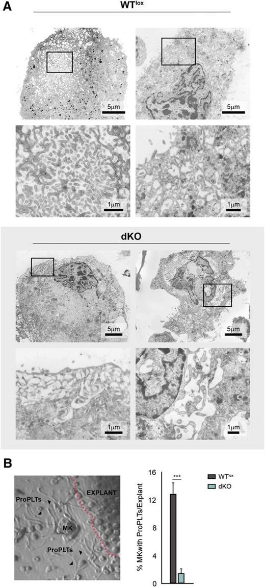Figure 3. dKO megakaryocytes display an aberrant DMS and are incapacitated to form proplatelets. (A) Electron microscope images of bone marrow–derived cultured megakaryocytes. Representative pictures are shown. WTlox megakaryocytes display a normal compact DMS, whereas dKO megakaryocytes present with an abnormal less compact DMS or even larger vacuolar cytoplasmic structures. See supplemental Figure 3 for additional pictures. (B) Micrograph of the periphery of a bone marrow explant (left) (contour indicated by dashed line). A megakaryocyte (MK) in the center of the image has formed proplatelets (ProPLTs, arrowheads). Such MKs with ProPLTs are counted as one unit, and the percentage of units with proplatelets of total counted megakaryocytes is depicted (bar graph on the right). See supplemental Videos 1-3 showing WT megakaryocytes forming proplatelets and supplemental Figure 4 for explant still images.