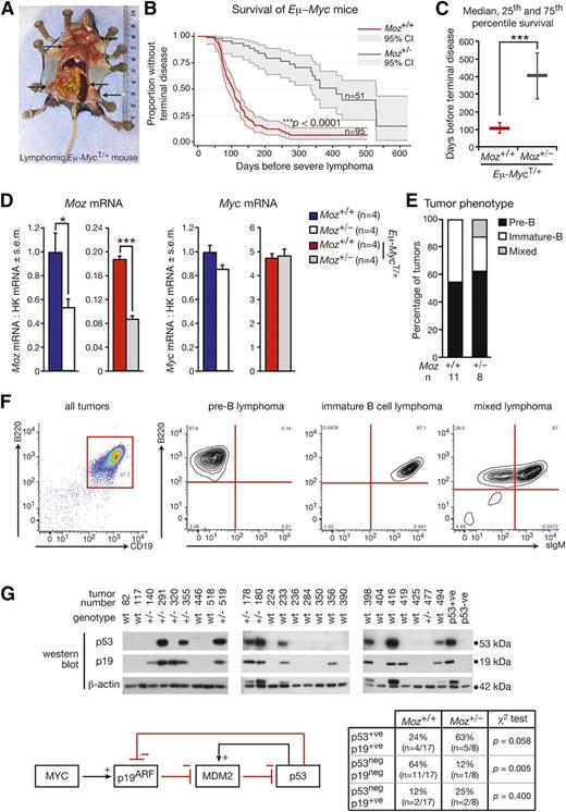 Figure 1. Loss of one allele of Moz increases lymphoma-free survival by 3.9-fold in the Eμ-Myc model. (A) Typical features of an Eμ-Myc lymphoma. Arrows indicate markedly enlarged lymph nodes and spleen, which are characteristic of Eμ-MycT/+ lymphoma. (B) Kaplan-Meier survival curves comparing Moz+/−; Eμ-MycT/+ and Moz+/+; Eμ-MycT/+ mice. Shading represents the 95% confidence interval. (C) Depiction of the median, 25th, and 75th percentile survival periods of Moz+/−; Eμ-MycT/+ and Moz+/+; Eμ-MycT/+ mice. (D) Moz and Myc mRNA levels in pre–B-cells. Gene expression levels were standardized to housekeeping genes Hsp90ab1 and Gapdh, and expression in WT samples was designated as 1. (E) Quantification of tumor immunophenotypes. (F) Representative flow cytometry plots depicting pre-B, immature B, and mixed pre-B/immature B-cell lymphomas. (G) Analysis of p53 and p19ARF status of tumor samples from Moz+/−; Eμ-MycT/+ and Moz+/+; Eμ-MycT/+ mice. High p53 expression is characteristic of most Trp53 mutations, as mutated p53 is no longer able to activate Mdm2, preventing the induction of p53 destruction (see schematic). Normally, high levels of p19ARF are evident in Eμ-Myc transgenic cells; however, upon Arf deletion, p19ARF protein is not detectable. Data above are presented as mean ± SEM. Asterisks indicate a statistically significant difference between Moz+/− and WT, or between Moz+/−; Eμ-MycT/+ and Moz+/+; Eμ-MycT/+ mice at *P < .05 and ***P < .001.