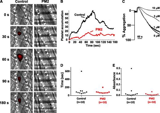 Figure 7. Parmodulin 2 inhibits thrombus formation without prolonging bleeding times. (A) Platelet-specific anti-GPIbβ antibody conjugated to Dylight 649 (0.1 µg/g body weight) was infused into mice. Thrombi were induced by laser injury of cremaster arterioles before (n = 62 thrombi in 7 mice) and after (n = 54 thrombi in 7 mice) infusion of parmodulin 2 (5 mg/kg body weight). Thrombus formation was visualized by videomicroscopy for 180 seconds after injury. Representative binarized images of platelets at the injury site before (Control) and after parmodulin 2 infusion (PM2) are shown. White arrowheads indicate the location of the vessel. (B) Median integrated platelet-fluorescence intensity at the injury site in mice before (Control) and after parmodulin 2 infusion (PM2) is plotted over time. (C) Mouse platelet aggregation in response to 65 μM AYPGKF was evaluated after incubation with the indicated concentrations of parmodulin 2. (D) Time to cessation of bleeding and (E) total hemoglobin loss was measured after tail-tip amputation.