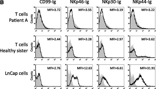 Figure 4. Killing of PHA-induced T-cell blasts. (A) Staining of PHA-induced T-cell blasts with various mAbs. Staining of PHA-induced T-cell blasts derived from patient A and from the healthy sister was performed with the F(ab′)2 fragments of anti-CD3, anti-CEACAM1, and anti-MHC class I mAb HP-1F7. (B) Staining of PHA-induced T-cell blasts and of the LnCap cell line with various fusion proteins. Staining was performed with the NKp46-Ig, NKp30-Ig, NKp44-Ig, and control CD99-Ig fusion proteins. (C) NK clones derived from patients A, B, and C were assayed for cytotoxic activity against autologous PHA-induced T-cell blasts. The NK clones obtained from the healthy sister were assayed against PHA-induced T-cell blasts derived from patient A. NK clones were preincubated with or without F(ab′)2 fragments of polyclonal anti-CEACAM or the control polyclonal antiubiquitin antibodies. The targets, autologous PHA-induced T-cell blasts, were incubated with or without the F(ab′)2 fragments of HP-1F7 or the control 12E7 mAb. Assays were performed at an E/T ratio of 2:1. Shown are the mean results of several NK clones that were obtained from 3 independent experiments. The data represent the mean percentage of killing ± standard deviation. (D) NK clones derived either from the healthy sister or from patients A, B, and C were assayed for killing of PHA-induced T-cell blasts derived from the healthy sister. NK clones and target PHA-induced T-cell blasts were pretreated as described for C. Assays were performed at an E/T ratio of 2:1. Shown are the mean results of several NK clones that were obtained from 3 independent experiments. All mAbs used were in the form of F(ab′)2. The data represent the mean percentage of killing ± standard deviation.