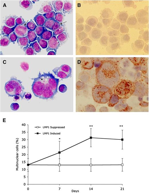 Figure 2. LMP1 expression in BJAB-tTA-LMP1 Burkitt lymphoma cells is associated with multinuclearity. Original magnification ×640, Zeiss AxioImager Z1 microscope. (A) LMP1-suppressed transfectants at day 7 still reveal uniform Burkitt cell morphology with only a few binucleated or large mononuclear cells (arrows) (Pappenheim staining). (B) Immunostaining with anti-LMP1 monoclonal antibody CS.1-4 confirms successful LMP1 suppression through tetracycline. (C) LMP1-expressing transfectants at day 7 contain multiple RS-like giant cells. Arrow points to a satellite nucleus (Pappenheim staining). (D) Strong LMP1 expression is confirmed with anti-LMP1 monoclonal antibody CS.1-4. (E) LMP1 induced accumulation of multinuclear cells. BJAB-tTA-LMP1 cells were induced for the expression of LMP1 for 21 days by removal of tetracycline. Samples from LMP1-induced and LMP1-suppressed cells at days 1, 7, 14, and 21 were cytocentrifuged and counted for the presence of multinucleated cells. For each time point, 200 cells were counted in 15 independent experiments. LMP1-induced formation of RS-like giant cells is evident. *P < .05; **P < .0001.