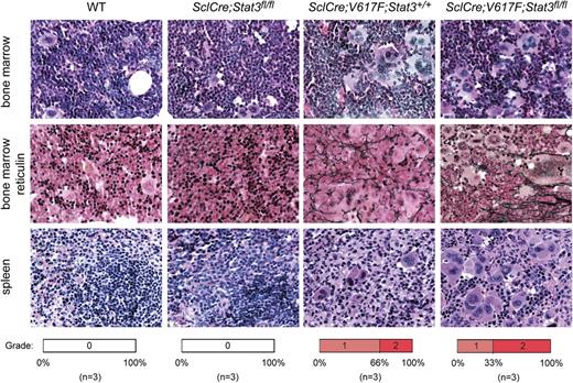 Figure 2. Histopathology of transgenic mice and controls. Mice were euthanized 25 weeks after starting tamoxifen. Hematoxylin-eosin and Gömöri staining of bone marrow and spleen are shown (magnification, ×400). Frequency of mice displaying grade 0, grade 1, or grade 2 myelofibrosis is shown in the lower panel for each genotype.