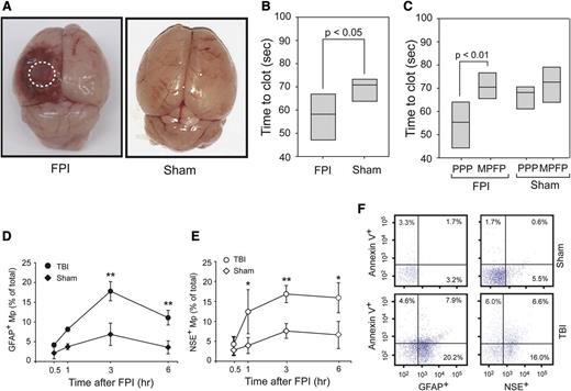 Figure 1. FPI-induced and BDMP-dependent coagulation. (A) Cerebral injury is visible in the left parietal lobe of a mouse 3 hours after FPI compared with the brain from a mouse subjected to sham surgery. (B) The clotting time of PPP collected from mice 3 hours after FPI or sham surgery was measured in a PS-dependent assay (n = 6, paired t test). (C) Clotting times were compared between PPP and homologous MPFP collected from mice subjected to FPI and sham surgery (n = 9, paired t test). (D-E) GFAP+ and NSE+ microparticles were detected by flow cytometry over time in blood samples from TBI and sham mice (n = 6 at each time point), and the values are after the subtraction of values from isotype IgGs (1-way ANOVA, n = 48, *P < .01, **P < .05). (F) Fractions of GFAP+ and NSE+ microparticles that express PS as measured by annexin V binding (a representative of 16 separate experiments).