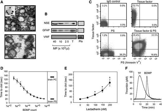 Figure 2. Procoagulant activity of BDMPs from freeze-thawing injury. (A) (Upper) TEM image of BDMPs (bar = 200 nm). (Inset) A microparticle stained with an immune-gold-labeled GFAP antibody (bar = 100 nm). (Lower) TEM image of BDMPs with negative staining to enhance the view of membrane structures (bar = 200 nm). (B) BDMPs and platelet microparticles solubilized in an SDS lysis buffer were probed for NSE, GFAP, and von Willebrand factor (T, whole brain lysate; Pts, platelet lysate as control). (C) The expression of TF, PS, and both was measured for BDMPs (represents 20 separate measurements). (D) PS-dependent clotting time was measured in the presence of increasing numbers of BDMPs (n = 6, 1-way ANOVA, P < .001) and compared with those induced by 1.6 μg/μL of purified brain PS and PC, respectively. (E) Plasma clotting times induced by 25 000/μL BDMPs were measured in the presence of increasing concentrations of bovine lactadherin. (F) TF-dependent thrombin generation was measured in reaction containing either 1 pM TF or 25 000 BDMPs (representative of 3 separate experiments).