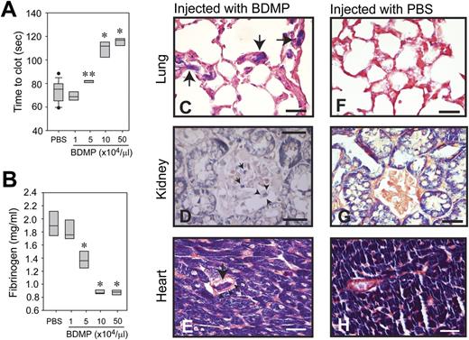 Figure 3. Coagulopathy induced by infusion of BDMPs into uninjured mice. (A) Blood samples were collected from mice infused with BDMPs or PBS and tested for PS-dependent clot formation (n = 12, 1-way ANOVA, **P = .036, *P < .001 compared with PBS). (B) Levels of fibrinogen were measured in the plasma samples collected for studies in A (n = 12, 1-way ANOVA, *P < .001 compared with PBS). Sections of formaldehyde-fixed lungs, kidney, and heart from mice injected with (C-E) BDMPs or (F-H) PBS were stained with phosphotungstic acid hematoxylin (dark blue; the dye also stains muscle cells). The left panel shows fibrin deposition in the microvasculature of the (C) lung, (D) kidney, and (E) stromatic vessels of the heart from mice injected with BDMPs (arrows). Arrowheads indicate intact walls of fibrin deposited vessels (bar = 25 μm). (F-H) Fibrin deposition was not detected in organs collected from mice receiving PBS (bar = 25 μm). Images are representative of 6 mice injected with BDMPs and 5 with PBS.