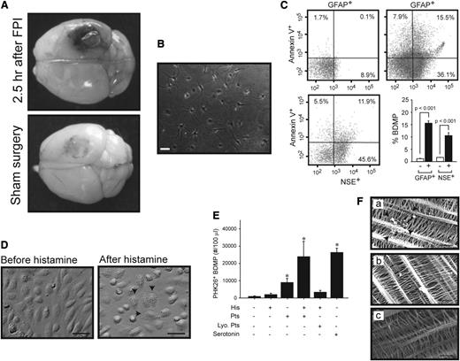 Figure 4. Production and transmigration of BDMPs. (A) Evans blue leaked from the vasculature of a mouse subjected to FPI, but significantly less from the one with sham surgery (representatives of 3 pairs of mice). (B) A representative image of hippocampal cells that were cultured for 7 days. (C) Cultured hippocampal cells were stimulated with 50 μM of the calcium ionophore A23187. The media collected (upper left) before and (upper right and lower left) after stimulation were analyzed for BDMPs by flow cytometry (n = 6, paired t test, P < .001). (D) HUVECs grown to confluence (left) become retracted and granulated (arrows) after being stimulated with 25 μM histamine (right; bar = 20 μm). (E) PKH26-labeled BDMPs detected in the bottom chamber by flow cytometry 3 hours after BDMPs were incubated with resting and histamine-activated (His) HUVECs in the presence and absence of 3 × 105/μL human live (Pts) or lyophilized (Lyo. Pts) platelets (n = 6/group, 1-way ANOVA, *P < .005 vs baseline). Serotonin (5 μM) also promotes microparticle transmigration in the absence of live platelets. (F) SEM images showing BDMPs (arrowhead) on the opposite side of the membrane from histamine-activated HUVECs that were incubated with BDMPs in the (a) presence and (b) absence of live platelets or (c) resting HUVECs incubated with BDMPs (bar = 5 μm).