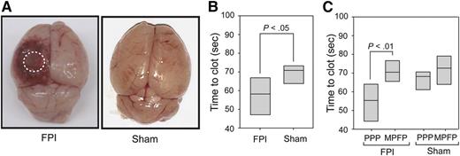 Trauma brain injury in mice and coagulation triggered by brain-derived microparticles. (A) Cerebral injury is visible in the left parietal lobe of a mouse 3 hours after induction of trauma using fluid percussion injury (FPI) compared with the brain from a mouse subjected to sham surgery (Sham). (B) The clotting time measured in platelet-poor plasma (PPP) collected from mice subjected to trauma brain injury (FPI) or sham surgery (Sham) was measured in a phosphatidylserine-dependent assay. (C) Clotting time was compared between PPP and homologous plasma depleted of any microparticles by centrifugation collected from mice subjected to trauma brain injury (FPI) and sham surgery (Sham). Adapted from Figure 1 in the article by Tian et al that begins on page 2151.