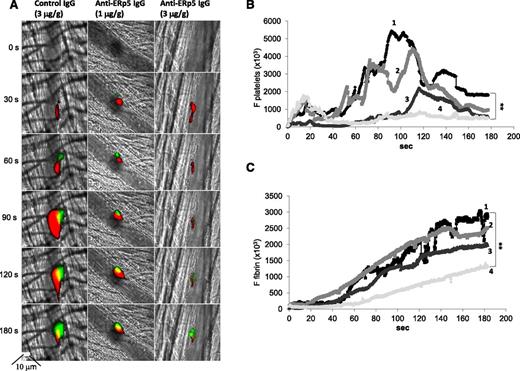 Figure 6. Anti-ERp5 antibody inhibits thrombus formation in vivo. (A) Anti-CD42b antibody labeled with DyLight 649 (0.1 µg/g body weight) and anti-fibrin-specific antibody labeled with Alexa Fluor 488 (0.5 µg/g body weight) were infused into a mouse 5 to 10 minutes prior to arteriolar injury. Preimmune IgG at 3 µg/g body weight (left) or anti-ERp5 antibody at 1 µg/g body weight (middle) and 3 µg/g body weight (right) were infused intravenously 20 minutes prior to injury. Representative binarized images of the fluorescent signal from platelets (red) and fibrin (green) over 180 seconds after laser-induced vessel wall injury show inhibition of thrombus formation with increasing concentrations of anti-ERp5 antibody. Median integrated platelet (B) and fibrin (C) fluorescence over time is shown before (1) vs after infusion of control IgG, 3 µg/g body weight (2); after anti-ERp5 antibody, 1 µg/g body weight (3); and after anti-ERp5 antibody, 3 µg/g body weight (4). **P < .01.