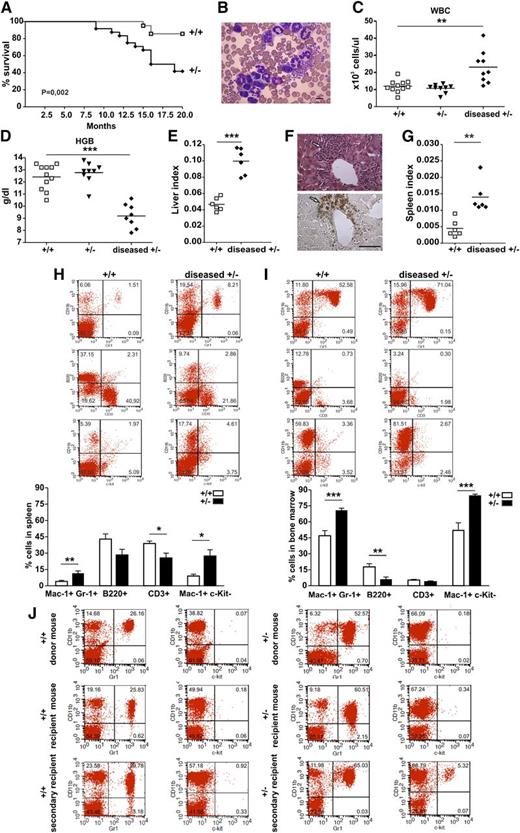 Figure 1. Evaluation of the spontaneous onset of hematopoietic neoplasm in morgana+/– mice. (A) Survival curves of morgana+/+ and morgana+/– mice. Kaplan-Meier analysis demonstrates a significant difference in survival (morgana+/+: n = 21 and morgana+/–: n = 25). (B) Representative picture of peripheral blood smears of diseased morgana+/– mice. The scale bar = 10 μm. (C-D) White blood cell (WBC) count and hemoglobin (HGB) values in the peripheral blood of diseased morgana+/– mice compared with healthy morgana+/– and wild-type littermates. (E) Liver/body weight ratios (liver index) of morgana+/–-diseased and wild-type mice. (F) Myeloid infiltration in the liver of morgana+/–-diseased mice as confirmed by myeloperoxidase staining. The scale bar = 100 μm. (G) Spleen/body weight ratios (spleen index) of morgana+/–-diseased and wild-type mice. (H-I) Flow cytometric analysis of (H) spleen and (I) BM single-cell suspension from diseased morgana+/– and wild-type littermates and relative quantifications (n = 6 mice per group). (J) Flow cytometric analysis on the peripheral blood of representative morgana+/– and morgana+/+ donor, primary, and secondary recipient mice are shown. *P < .05, **P < .01, ***P < .001.