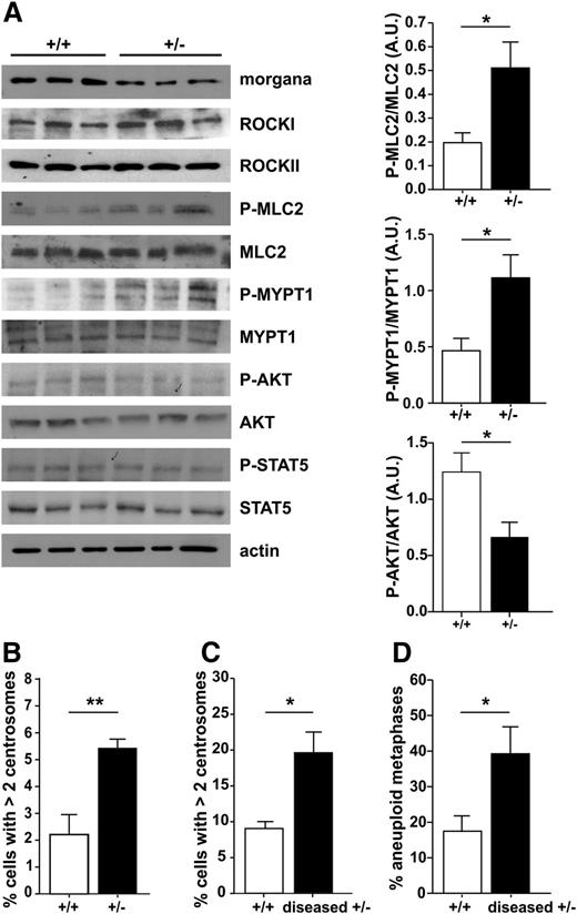 Figure 2. Molecular pathogenesis of morgana+/– myeloproliferative disease. (A) Western blot analysis of BM protein extracts from morgana+/+ and morgana+/– mice before disease onset, stained with antibodies against morgana, ROCKI and II, phosphorylated MLC2 (P-MLC2), total MLC2, P-MYPT1, total MYPT1, P-AKT, total AKT, P-STAT5, total STAT5, and actin, used as a loading control. The graphs show the densitometric quantification of P-MLC2, P-MYPT1, and P-AKT bands normalized to total MLC2, MYPT1, and AKT (n = 3 mice per group). Note that ROCKI, ROCKII, and STAT5 phosphorylation were similar in morgana+/+ and morgana+/– BM. (B) Percentages of BM cells with >2 centrosomes in 8-month-old morgana+/+ (n = 6) and morgana+/– (n = 5) mice. (C) Percentages of BM cells with >2 centrosomes in morgana+/–-diseased mice and morgana+/+ littermates (n = 4 mice per group). (D) Percentages of aneuploid metaphase spreads obtained from the BM of morgana+/+ and morgana+/–-diseased mice (n = 4 mice per group). *P < .05, **P < .01.