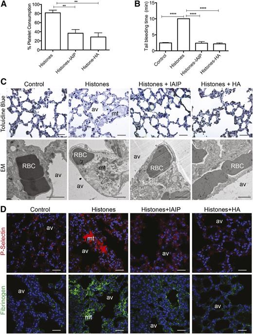 Figure 5. IAIP and HMW-HA prevent histone-induced thrombocytopenia, prolonged bleeding time, microthrombosis, and fibrinogen accumulation. (A-B) Percentage of (A) platelet consumption and (B) tail bleeding time in mice injected intravenously with 50 mg/kg histones without (n = 6) or with preincubation with IAIP (50 mg/kg; n = 6) or HMW-HA (90 mg/kg; n = 6). Data are presented as mean ± SEM of 3 independent experiments using one-way ANOVA with Bonferroni’s multicomparison test. ****P < .0001 and **P < .01 compared with the histones challenge group. (C-D) Pathologic changes in mouse lungs 3 hours after intravenous injection of 50 mg/kg histones with or without preincubation with IAIP or HMW-HA. (C) Toluidine blue staining on semi-thin epon sections (upper row) and electron microscopy (EM; lower row), and (D) immunofluorescence staining for platelet marker P-selectin (upper row; red) and fibrinogen and/or fibrin (lower row; green) demonstrate the presence of platelet and fibrin-rich intravascular microthrombi (mt) in histone-only treated mice compared with controls and mice injected with histones pretreated with IAIP or HMW-HA. Magnification bars for (C): toluidine blue, 100 µm; EM, 1 µm; for (D): all bars are 100 µm. av, alveoli; RBC, red blood cells.