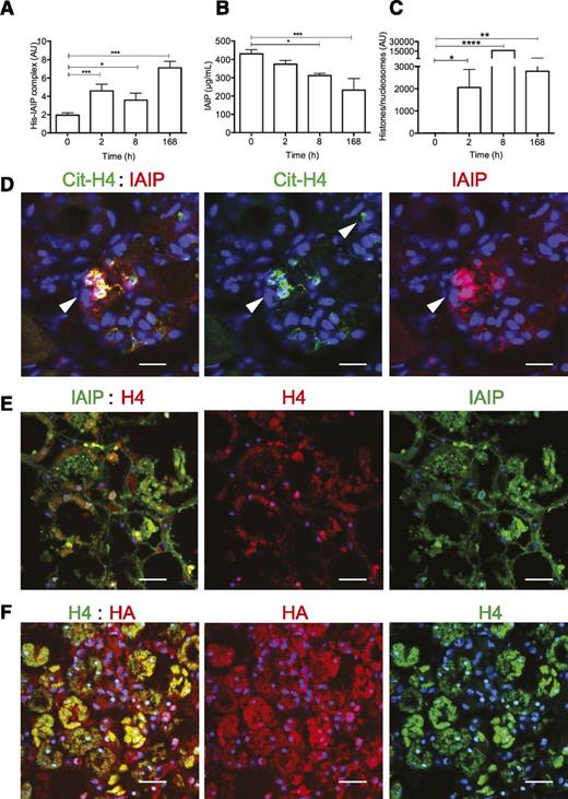 Figure 7. Detection of histone-HA and histone-IAIP complexes in plasma and tissues of baboons challenged with a lethal dose of E coli. (A) Histone-IAIP (His-IAIP) complexes, (B) total IAIP, and (C) histones and/or nucleosomes were detected in plasma of baboons challenged with E coli by intravenous infusion. T0 is the time of blood collection before E coli challenge. Data are shown as mean ± SEM of 3 independent experiments using one-way ANOVA with Bonferroni’s multicomparison test. ****P < .0001, ***P < .0001, **P < .01, and *P < .05 compared with the time of blood collection before E coli challenge (T0). (D) Immunohistochemical detection of IAIP (red) and cit-H4 with an antibody detecting citrulline at residue 3 (Cit-H4, green) in kidney sections from septic baboons shows colocalization of the 2 proteins (yellow) with neutrophil extracellular traps (arrows). Magnification bar: 50 µm. (E) Colocalization for IAIP (green) and H4 (red; overlap, yellow) in areas showing tubular necrosis in the kidney from a septic baboon. Magnification bars: 100 µm. (F) Colocalization of HA (red) with H4 (green) in areas with tubular necrosis of the kidney from a septic baboon. Magnification bars: 100 µm.