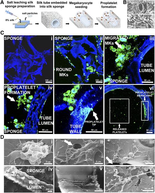 Figure 5. Silk microtube assembly and sponge preparation into the bioreactor chamber and analysis of platelet production within this system. (A) Aqueous silk is dispensed into the chamber around the microtube and salt particles are added. After leaching out the salt, the resulting porous silk sponge is trimmed and sterilized. After seeding into the silk sponge, Mks migrate toward the microtube, adhere, and extend proplatelets through the microtube wall to release platelets into the microtube lumen. (Bi) SEM image showing a silk microtube embedded into the silk sponge (scale bar = 100 μm). (Bii) SEM image showing the porous morphology of silk sponge (scale bar = 100 μm). (C) Confocal microscopy analysis of different steps of Mks behavior within the silk microtube-sponge tissue system. (Ci) Silk sponge before Mks seeding (scale bar = 100 μm). (Cii) Mature Mks immediately after seeding into the silk sponge (green = CD61; blue = nuclei; scale bar = 100 μm). (Ciii) Migrated Mks in close contact with the microtube wall (green = CD61; blue = nuclei; scale bar = 50 μm). (Civ) Mks forming proplatelet on adhesion to the microtube wall (green = CD61; blue = nuclei; scale bar = 50 μm). (Cv) Mk extending proplatelets through the silk microtube wall. Arrow indicates proplatelet branch elongation through microtube wall with proplatelet tip protruding into the microtube lumen (green = CD61; blue = nuclei; scale bar = 50 μm). (Cvi) Boxes highlight proplatelet branches detectable along the inner wall of the silk microtube and platelets released into the microtube lumen (green = CD61; blue = nuclei; scale bar = 50 μm). For all immunofluorescence analysis, silk fibroin 3D scaffolds were stained with Hoechst 33258 and visualized in blue. (D) SEM imaging of different steps of Mks behavior within the silk microtube-sponge tissue system. (Di) Mature Mks adhesion on silk microtube outer wall (scale bar = 2 μm). (Dii-Diii) Migrated Mks forming proplatelet on adhesion to the microtube wall (scale bar = 2 and 10 μm). Arrows indicate silk pores that allow proplatelet elongation inside microtube lumen. (Div) Longitudinal section of silk microtube-sponge tissue system (scale bar = 200 μm). (Dv) Mk extending proplatelets through silk microtube wall (scale bar = 10 μm). (Dvi) Proplatelet branch stemming inside microtube lumen and released platelets (scale bar = 10 μm).