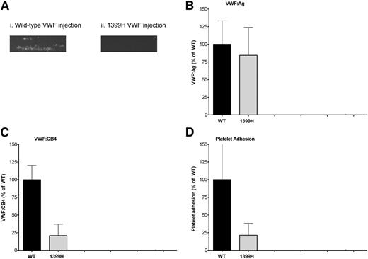 Figure 4. Murine 1399H VWF demonstrates defect in shear-induced collagen 4 binding. VWF-deficient mice were injected with either WT or p.1399H murine VWF DNA to achieve temporary correction of their VWF levels. Blood samples were obtained 24 hours postinjection. Binding to collagen 4 under flow conditions was assessed using the Venaflux system at 37°C using a shear rate of 1111 s−1. Platelets were labeled with mepacrine for visualization. (A) Platelet adhesion after 180 seconds for a representative sample from a mouse injected with WT VWF (panel 1) and a mouse injected with 1399H VWF (panel 2). Images were obtained using a Zeiss Axio Observer.A1 microscope at ×10 original magnification and a Hamamatsu Orca R2 camera. (B) VWF:Ag levels obtained 24 hours postinjection for WT (n = 4) and 1399H (n = 4) mice. (C) VWF:CB4 levels obtained 24 hours postinjection for WT (n = 4) and 1399H (n = 4) mice. (D) Platelet adhesion as measured by number of platelet aggregates for 1399H-injected mice (n = 3) compared with WT-injected mice (n = 4).
