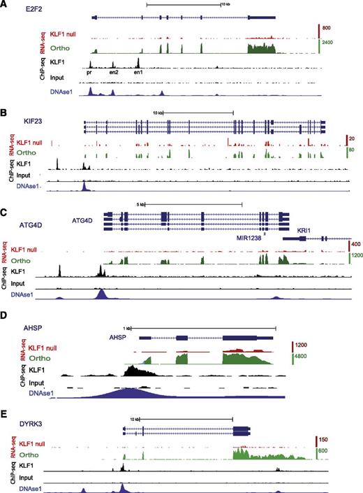 Figure 5. KLF1 regulates genes involved in cell-cycle control, cytokinesis, autophagy, globin synthesis, and cell signaling. Screen captures from the UCSC Genome Browser (hg19) with RefSeq transcripts for gene(s) at the top (blue) and the direction of transcription shown by arrowheads. All alternative transcripts from the RefSeq repository are included. Coding exons have an expanded vertical height compared with noncoding (5′ or 3′ untranslated region) per UCSC custom. The wiggle tracks for mapped and aligned RNA-seq tags are shown for the proband (KLF1 null, red) and orthochromatic erythroblasts (Ortho, green).36 Tags are highly enriched over exons as expected for polyA+ RNA-seq libraries. The top of the vertical scale for orthochromatic erythroblasts (tag counts) at each gene varies from 80 to 20 000, which reflects the broad range of gene expression detectable by RNA-seq (refer to supplemental Table 1 for FPKM values). The scale for the KLF1 RNA-seq track is 4 times lower to amplify its height to provide a “normalized” comparison with the green track (see Methods). Wiggle tracks for ChIP-seq data for KLF1 and input DNA (black) were uploaded from GEO.37 The wiggle track for DNase 1 HS-seq data from K562 cells generated by the ENCODE consortium (see Methods) was uploaded to show likely promoter and enhancer sites (bottom track, navy). KLF1 directly regulates expression of E2F2 (A), KIF23 (B), ATG4D (C), AHSP (D), and DYRK3 (E). The 5 genes are poorly expressed in the proband (red tracks) compared with orthochromatic erythroblasts (green tracks). ChIP-seq peaks at the promoter (pr) and 2 first intron enhancer sites (en1 and en2) are identical to previously described Klf1-occupied sites in the murine E2f2 gene.51 KLF1 binds the KIF23 promoter and a site ∼3 kb upstream, the ATG4D promoter and a site ∼1 kb upstream, the AHSP promoter, and the DYRK3 promoter and a site ∼3 kb upstream (black tracks). Most of these display erythroid DNAse1 hypersensitivity (blue track).