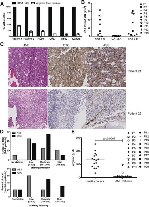 Figure 1. AML blasts are auxotrophic for arginine. (A) AML patients’ blasts and AML cell lines were cultured in complete or arginine-depleted media. The viability of AML blasts from patients and cell lines was assessed by flow cytometry after 72 hours. Arginine depletion leads to a decreased percentage of viable blasts. Representative of 2 independent experiments. (B) Expression of CAT-1, CAT-2A, and CAT-2B in blasts from 10 patients was confirmed by quantitative polymerase chain reaction (qPCR). Patients are identified by unique symbols, which are used consistently throughout the manuscript. (C) Staining of 39 bone marrow samples from AML patients at diagnosis with hematoxylin-eosin (left panel), anti-OTC (center panel), and anti-ASS (right panel). Representative marrows from 2 patients showing positive antigen staining (top) and negative antigen staining (bottom). (D) Histoscores of ASS and OTC staining in adult and pediatric AML bone marrow samples. (E) Plasma from 20 AML patients at diagnosis and 16 healthy donors were analyzed for arginine concentration by enzyme-linked immunosorbent assay (ELISA). Plasma arginine levels are significantly lower in newly diagnosed patients (P < .0001).