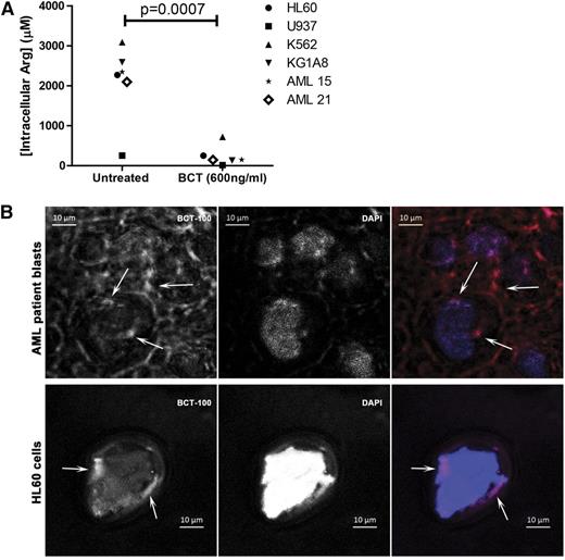 Figure 4. BCT-100 depletes arginine intracellularly. (A) Cell lines or patient samples were cultured with BCT-100 (600 ng/mL) for 72 hours. Intracellular arginine concentrations were measure by ELISA. BCT-100 causes a depletion of intracellular arginine. Data are representative of 2 independent experiments. (B) Internalization of BCT-100-AF647. AML blasts (top panel) and HL60 cells (bottom panel) were incubated with fluorescently labeled BCT-100 for 8 hours. Unbound drug was removed with stripping buffer and extensive washing. Nucleus was stained with 4,6 diamidino-2-phenylindole (DAPI). Images of representative cells were collected by LSM510 system (Zeiss). Arrows indicate intracellular localization of labeled BCT-100; arrowheads indicate surface-bound drug. Scale, 10 μm. Representative patient sample of 3 different patient samples.