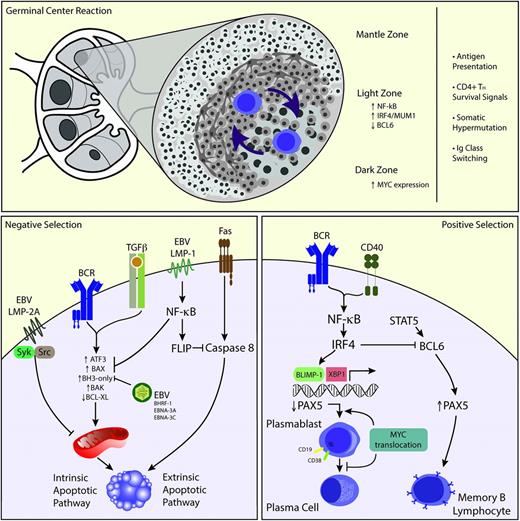 Figure 1. Proposed biology of PBL. The GC reaction occurs in the primary follicle. Naïve B cells gain exposure to antigen, and B-cell clones undergo selection by alternating between the dark and light zones of the GC (upper panel). EBV infection could play a role in preventing apoptosis via several mechanisms such as induction of NF-κB, through Syk/Src mediation, and induction of BAX/BAK (left lower panel). Conversely, MYC translocations could allow B cells to escape the inhibitory influence of BLIMP-1 favoring plasmablast development but then inhibiting further plasmacytic differentiation by downregulating PAX5 (right lower panel). TH, T helper cell.
