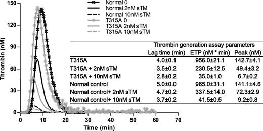 Figure 4. Assessment of thrombin generation in the absence and presence of sTM in normal and proband plasma. Citrated normal or test plasma (80 µL) was incubated with 20 µL PPP reagent in the absence and presence of either 2 nM or 10 nM sTM and thrombin generation was analyzed as described in “Materials and methods.”