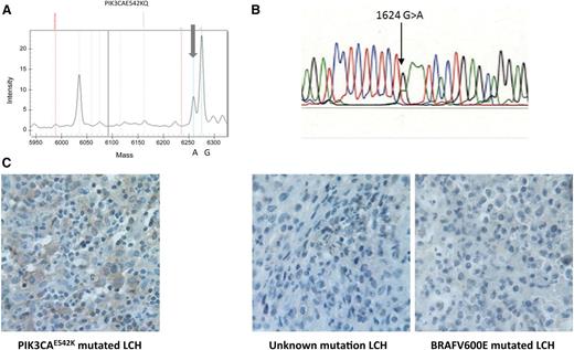 Figure 1. Detection of PIK3CAE542K mutation. (A) Sequenom mass-spectrometric–based genotyping assays. Mutants are detectable with the appearance of a new peak (gray arrows) with an allele frequency ∼25% in a lesion with 50% tumor infiltration. (B) Sanger sequencing. (C) Anti–phospho-AKT staining in the PIK3CAE542K mutated LCH. Histiocytes from an LCH lesion of the patient with PIK3CA542K mutation show positive cytoplasmic staining in comparison with histiocytes from 2 LCH lesions from patients without the PIK3CA542K mutation (1 patient with the BRAFV600E mutation and 1 patient without a known mutation).