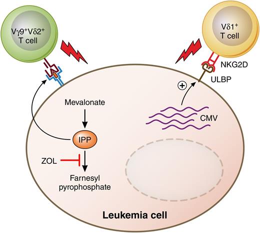 Putative antileukemia anti-CMV activities of human γδ TCR-bearing T cells. ZOL and other bisphosphonates inhibit a key enzyme of the mevalonate pathway of cholesterol biosynthesis, leading to accumulation of IPP in acute leukemia cells. IPP is one of the nonpeptide phosphoantigens that are recognized by and stimulate cytolysis by human Vγ9+Vδ2+ T cells. Meanwhile, human CMV glycoprotein UL16 binds to the MHC class I–related molecule UL16-binding protein (ULBP) and stimulates the natural killer cell stimulatory receptor NKG2D, also found on Vδ1+ T cells. Professional illustration by Patrick Lane, ScEYEnce Studios.