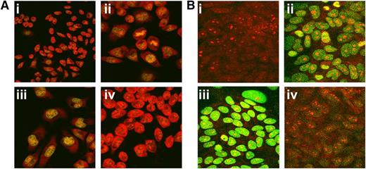 Figure 7. Induction of apoptosis in RBL and MCF7 cells after treatment with anti–Bcl-2-scFv-TAT. Cells were exposed to anti–Bcl-2-scFv-TAT or nonspecific scFv-TAT for 72 hours. Apoptosis was determined by TUNEL assay and the cells were observed under a fluorescent microscope at ×40 magnification. Untreated RBL (Ai) and MCF7 (Bi) cells. RBL (Aii) and MCF7 (Bii) cells exposed to DNaseI as positive control. The cells show DNA fragmentation and fluorescent labeling. RBL (Aiii) and MCF7 (Biii) cells treated with anti–Bcl-2-scFv-TAT. The nuclei of the cells show fragmentation and fluorescent staining. RBL (Aiv) and MCF7 (Biv) cells treated with nonspecific scFv-TAT. The cells show morphologic similarity to untreated cells.