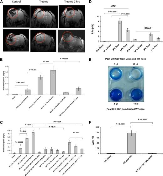 Figure 3. CHI in mice induces time-dependent expansion of ICH. ICH induced by CHI was evaluated by MRI and by measuring extravasation of hemoglobin. (A) The hemorrhagic area was evaluated 24 hours post-CHI by T2*-weighted images in untreated WT mice (Control), mice given tPA-S481A (1 mg/kg) either immediately after CHI (Treated) or 2 hours later (Treated 2 hrs). Images from 2 representative mice from each group (n = 5 each) are shown in the top and bottom panels. The hemorrhagic areas are delineated by circles. (B) Reduction in hemorrhage by tPA variant. WT mice were given saline (Cont) or tPA-S481A (1 mg/kg) immediately after or 2 hours post-CHI, and the extravasation of hemoglobin into a lysate of whole brain was quantified by spectrophotometry34 2, 8, or 24 hours later. The mean ± SD of 3 experiments performed in 5 to 7 mice is shown. (C) Comparative effect of inhibitors of plasminogen activation on hemorrhage 2 hours posttrauma. Immediately after CHI, WT mice were given saline (Cont), WT-tPA (5 mg/kg) or tPA-S481A (1 mg/kg), WT-tPA (5 mg/kg) plus tPA-S481A (5 mg/kg), tranexamic acid (TA; 150 mg/kg), aprotinin (Ap; 1 mg/kg), TA plus Ap, WT-tPA plus TA, WT-tPA plus Ap, or WT-tPA plus TA plus Ap, as indicated. Extravasation of hemoglobin into a lysate of whole brain was quantified by spectrophotometry34 2 hours later. The mean ± SD of 3 experiments performed in 5 to 7 mice is shown. (D) Trauma induces tPA and uPA from brain parenchyma. The concentrations of tPA and uPA in the CSF of WT mice were measured by enzyme-linked immunosorbent assay before (Sham) or 2 hours after (Post) CHI. The mean ± SD of 3 experiments performed in 5 to 7 mice is shown. (E) Trauma induces fibrinolytic activity. The fibrinolytic activity of CSF was measured 2 hours post-CHI. Upper line: CSF (5 µL or 10 µL) obtained 2 hours after CHI from untreated mice was placed on top of plasma-derived clots as in Figure 2A. Lower line: CSF obtained 2 hours after CHI from mice treated with tPA-S481A (1 mg/kg) immediately post-CHI. Data represent results from 1 of 3 independent experiments. (F) tPA variant inhibits fibrinolytic activity posttrauma. The fibrinolytic activity of CSF taken 2 hours after CHI from untreated mice or mice given tPA-S481A (1 mg/kg) immediately posttrauma was quantified as in Figure 2B. The mean ± 2 SD of 3 experiments performed in 4 to 8 mice is shown. The statistical significance of experimental differences in this set of experiments and in those that follow was analyzed using 1-way analysis of variance with Newman-Keuls post hoc test.33