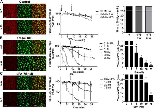 Figure 1. Concentration-dependent effect of plasminogen activators on fibrin degradation of thrombi under flow. Platelet-fibrin thrombi were formed by perfusion (1000 s−1) of whole blood for 7 minutes over collagen/TF in the absence or presence of tPA or uPA (0 nM to 75 nM). Blood samples were pre-incubated with DiOC6 (0.5 µg/ml) to label platelets and fibrinogen-AF647 (16.7 µg/ml). The fluorescent thrombi were perfused (t = 0) with buffer 1 (HEPES buffer, pH 7.45) for 8 minutes, followed by buffer 2 (HEPES buffer, pH 7.45 with the indicated concentration of tPA or uPA) for up to 28 minutes. Shown are representative images of thrombi labeled for fibrin(ogen) (red), platelets (green), and label overlay (yellow) (left panels). Scale bars represent 50 µm. Also shown is dose-dependent fibrinolysis in time, expressed as fibrin(ogen)-AF647 surface coverage (% of t = 0, ± SEM) (middle panels), and time to 50% lysis (right panels). (A) Absence of plasminogen activators, light bars represent controls where 75 nM tPA or uPA were present in buffer 2 only and not during thrombus formation. (B) tPA-mediated fibrinolysis and (C) uPA-mediated fibrinolysis. Data represent mean ± SEM, *P < .05 vs no tPA or uPA, n ≥ 3.