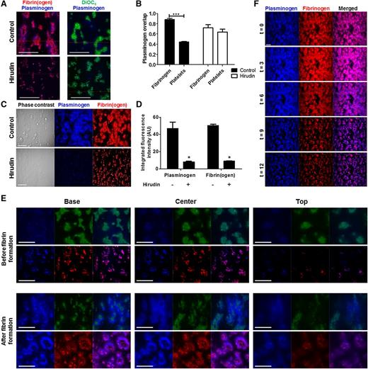Figure 3. Plasminogen localization within thrombi. Thrombi were formed by whole blood perfusion (1000 s−1) over a collagen/TF-coated surface with or without hirudin (3 µg/ml). Platelets labeled with DiOC6 (0.5 µg/ml) or fibrinogen-OG488 (75 µg/ml) was included. Thrombi were perfused with plasminogen–DL-633 (0.8 µM). (A) Representative overlays of plasminogen (blue) and fibrin(ogen) (red), or platelets (green). (B) Overlap coefficients (R) for plasminogen with fibrin(ogen) and/or platelets as determined using Zeiss Live 7 software. (C) Representative images of thrombi labeled for plasminogen-DL633 (blue) and fibrin(ogen)-OG488 (red). (D) Quantification of plasminogen and fibrinogen fluorescence intensity (AU). (E) Confocal z-stacks were recorded of labeled thrombi (16-bit images of 1024 × 1024 pixels; 106 × 106 μm; stack distance 0.5 μm; 50 slices). Representative images and overlays of plasminogen (blue) and platelets (green), or fibrin(ogen) (red) taken from z-stacks at the base (0 μm), center (10 μm), and top (20 μm) of thrombi before (top panel) or after (bottom panel) visible fibrin formation. (F) Thrombi were formed as above after pre-incubation with plasminogen–DL-633 (0.8 µM) and fibrinogen-OG488 (75 µg/ml) in the presence of 10 nM tPA. The fluorescent thrombi were perfused (t = 0) with buffer 1 (HEPES buffer, pH 7.45) for 8 minutes, followed by buffer 2 (HEPES buffer, pH 7.45 with 10 nM tPA) for up to 28 minutes. Shown are representative images of thrombi labeled for fibrin(ogen) (red) and plasminogen (blue). Scale bars represent 50 µm. *P < .05; ***P < .001. Data represented as mean ± SEM, n ≥ 3.