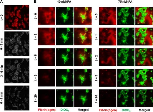 Figure 4. Fibrinolysis is delayed in fibrin immediately proximal to the platelet surface. Thrombi were formed by whole blood perfusion (1000 s−1) over a collagen/TF-coated surface for 7 minutes in the presence of 10 nM tPA. Thrombi were subsequently perfused (t = 0) with HEPES buffer, pH 7.45 for 8 minutes, and then HEPES buffer containing 10 nM tPA. (A) Representative image of fibrin(ogen)-AF647 staining on thrombi at the start and images subjected to subtraction analysis of fibrinogen fluorescence (n = 3). (B) Blood samples were pre-incubated with DiOC6 (0.5 µg/ml) to label platelets and fibrinogen-AF647 (16.7 µg/ml). Thrombi were allowed to form as above in the presence of 10 nM or 75 nM tPA. The fluorescent thrombi were perfused (t = 0) with buffer 1 (HEPES buffer, pH 7.45) for 8 minutes, followed by buffer 2 (HEPES buffer, pH 7.45 with indicated concentration tPA) until lysis was complete. Representative images and overlays of platelets (green) and fibrin(ogen) (red) during lysis with 10 nM or 75 nM tPA. Images are representative of n = 8. Scale bars represent 50 µm.