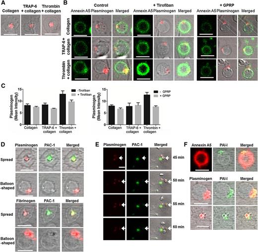 Figure 7. Plasminogen localizes in “caps” of PS-exposing platelets. Platelets (0.5 × 108/ml) were adhered to a collagen (0.6 µg) ± thrombin (3 pmol) or ± TRAP-6 (0.45 µmol) coated slide ± GPRP (5 mM) or ± tirofiban (1 µg/ml). After 40 minutes incubation, plasminogen-DL633 (0.8 µM) or fibrinogen-AF647 (16.7 µg/ml) was added for 5 minutes. (A) Spread PS-negative platelets showing plasminogen-DL633 binding. (B) Plasminogen-DL633 binding on PS-positive platelets (left) ± tirofiban (middle), or GPRP (right). Annexin A5–FITC (1/20 dilution) and 2 mM CaCl2 were added immediately prior to imaging. (C) Representative quantification of plasminogen-DL633 binding expressed as mean intensity ± SEM determined using Bitplane’s Imaris ×64 software. (D) Platelets on collagen + thrombin surface stained with PAC-1 FITC showing plasminogen-DL633 (top panel) and fibrinogen-AF647 (bottom panel) binding on spread- and balloon-shaped subpopulations. (E) Platelets on collagen + thrombin surface stained with PAC-1 FITC and showing plasminogen-DL633 binding. Arrows indicate a platelet with plasminogen bound that tethers to a spread plasminogen-positive platelet, which subsequently expresses active αIIbβ3, represented by positive PAC-1 staining. Images were recorded every minute for 60 minutes and selected images are shown. (F) Staining for platelet-derived PAI-1 in collagen + thrombin-stimulated platelets using an anti–PAI-1 DyLight 488 antibody and PS (Annexin A5-AF647) (top). PAI-1 co-localization with plasminogen-DL633 in balloon-shaped (middle) and spread platelets (bottom). Scale bars represent 5 µm. Images are representative of n = 3.