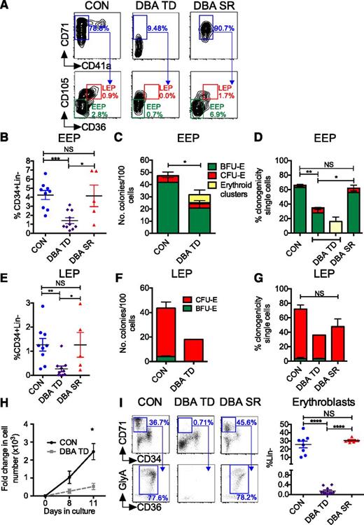 Figure 2. Specific EEP and LEP defects in DBA. (A) EEP and LEP were quantified by flow cytometry. Representative plots from a patient with TD DBA, SR DBA, and an age-matched control are shown. Values refer to frequency of CD71+CD41a− cells as a % of MEP, and frequency of EEP and LEP as a % of CD34+Lin− population. (B) Frequency of BM EEP in TD DBA (n = 10), SR DBA (n = 5), and control BM (n = 9) as assessed by flow cytometry. (C) Frequency of BFU-E colonies generated from 100 flow-sorted DBA and control EEP (n = 4). (D) Clonogenicity of TD DBA (n = 4), SR DBA (n = 3), and control EEP (n = 6) flow-sorted as single cells. (E) Frequency of LEP in TD DBA (n = 10), SR DBA (n = 5), and control BM (n = 9) as assessed by flow cytometry. (F) Clonogenicity of DBA TD (n = 2; due to insufficient LEPs in TD DBA BM for sorting) and control (n = 4) LEP after sorting and plating of 100 cells. (G) Clonogenicity of TD DBA (n = 2), SR DBA (n = 3), and control LEP (n = 5) flow-sorted as single cells. (H) Proliferative capacity of flow-sorted DBA and control EEP in a longitudinal liquid culture (Protocol B; supplemental Materials and methods) assessed by cell counting (n = 4). Cells on day 11 were a pure population of erythroblasts (ie, CD34−CD71+GlyA+CD14−CD11b−CD41a−). (I) Left: BM erythroblasts arising downstream of EPs were identified as Lin− (not shown) CD34−CD71+ BM mononuclear cells (top panel) co-expressing CD36 and GlyA (bottom panel). Representative flow cytometry plots from a control, a TD patient with DBA, and a DBA patient successfully treated with steroids are shown. Right: Cumulative data from controls (n = 8), TD (n = 10), and steroid-treated (n = 5) DBA patients. Data are shown as mean ± SEM. *P < .05; **P < .01; ***P < .001; ****P < .0001.