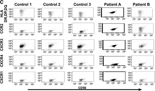 Figure 7. Analysis of NK cells and cytokines in serum and bronchioalveolar lavage samples from patients with TAP-2 deficiency. (A) Serum samples obtained from patients A, B, and C, their mother, and 9 healthy donors were analyzed by ELISA assays for the detection of MCP-1 (), SDF1 (□), IP10 (■), and secondary lymphoid tissue chemokine (SLC; ) chemokines. Results are of 1 representative experiment of 3 experiments performed on serum samples obtained on 3 independent occasions from each donor. (B) MCP-1 () and IL-2 (□) levels in BAL samples obtained from patients A and B were compared with those in BAL samples obtained from 5 controls without underlying pulmonary disease. (C) Purified NK cells from BAL samples obtained from patients A and B were compared with those of BAL samples obtained from 3 immunosuppressed patients with sustained lung infection and inflammation and were analyzed for the expression of HLA-DR, DP, DQ, CCR2, CXCR3, CXCR4, and CXCR1 receptors. **P < .001 by Student t test. Error bars indicate SD.