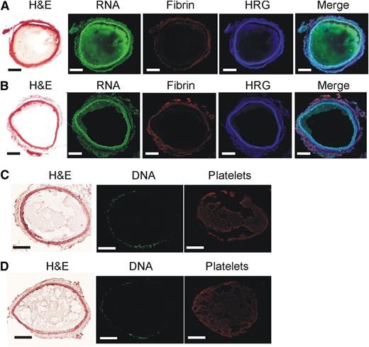 Figure 3. RNA is detected in thrombi harvested from mice after FeCl3-induced carotid artery injury. Representative thrombi harvested from the carotid artery of wild-type mice pretreated with (A,C) saline, (B) RNase, or (D) DNase. Before injury, mice were infused with an RNA- or DNA-specific fluorescent stain to identify RNA and DNA, respectively, within the thrombus. Thrombi were sectioned and subjected to immunofluorescence analysis using antibodies against HRG, fibrin, or platelets, or were stained with hematoxylin and eosin (H&E). Histologic sections were visualized with a ×100 objective lens fitted to an Olympus BX41 microscope equipped with a DP72 camera. Scale bars represent 100 μm.