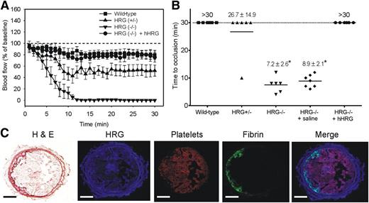 Figure 5. HRG deficiency is associated with accelerated thrombosis after FeCl3-induced arterial injury. (A) Changes in blood flow after FeCl3-induced carotid artery injury in wild-type, HRG+/−, or HRG−/− mice, and HRG−/− mice given human HRG to 2 μM or saline (n = 6 or 7/group). Thrombosis was initiated by application of a 1 × 1-mm filter paper presoaked in 7.5% FeCl3 for 1 minute to the right carotid artery. Blood flow was continuously measured before and for 30 minutes after injury. Flow measurements at the times indicated were expressed as a percentage of baseline flow. Symbols represent the mean, and the bars reflect the SE. (B) TTO values in wild-type, HRG+/−, or HRG−/− mice, and HRG−/− mice given human HRG or saline. TTO was defined as the time required for blood flow to decrease to <20% of the baseline value for at least 3 consecutive minutes. TTO data are presented as a scatter diagram, where symbols represent individual values, and horizontal lines represent the mean in each of the 5 groups. Values represent mean ± SD; *P < .001 compared with wild-type mice (ANOVA, Holm-Sidak method). (C) Representative thrombus harvested from the carotid artery of a wild-type mouse 30 minutes after FeCl3-induced injury and subjected to immunofluorescence analysis using antibodies against HRG, platelets, or fibrin, or stained with hematoxylin and eosin (H&E). Histologic sections were visualized using a ×100 objective lens fitted to an Olympus BX41 microscope equipped with a DP72 camera. Scale bars represent 100 μm.