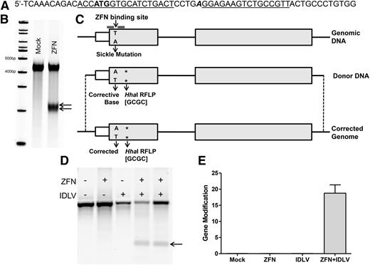 Figure 1. Cleavage and correction at the β-globin locus in CD34+ cells using an IDLV donor. (A) A portion of exon I of β-globin showing the ZFN target site (underlined) atop the start codon (bold) and the location of the sickle mutation (bold, italic). (B) Representative gel showing targeted cleavage at the β-globin locus in CB CD34+ cells. Cells were analyzed 3 days after electroporation with in vitro transcribed mRNA encoding the ZFNs. Mock represents untreated CD34+ cells. Arrows indicate cut bands following PCR amplification and digestion with Surveyor Nuclease. (C) Schematic of site-specific gene correction at the sickle mutation. Details of the donor construct and resulting genomic DNA on cleavage by ZFNs and repair by HDR. Location of sickle mutation and HhaI RFLP (asterisk) is indicated. Translated regions of exons to scale, introns, and 5′ untranslated region not to scale. (D) Representative RFLP gel for targeted gene modification of β-globin. CB CD34+ cells were electroporated with in vitro transcribed ZFN mRNA and transduced with donor IDLV. Cells were harvested 4 days after treatment, PCR amplified from outside the donor region, digested with HhaI enzyme, and resolved on an agarose gel. Arrow shows cleaved product, indicating incorporation of the RFLP into the genome at the target site. (E) Gene modification percentages in CD34+ cells. CB CD34+ cells were electroporated with in vitro transcribed ZFN mRNA (10 μg/mL) and transduced with donor IDLV (2 × 107 TU/mL). Cells were harvested 3 days after treatment and PCR amplified from outside the donor region, and qPCR was completed with primers designed to specifically detect the incorporation of the silent base change generating the HhaI RFLP and normalized to primers binding in exon II of the β-globin locus in the amplicon (n = 4 for all conditions). Error bars, mean ± standard deviation.